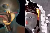 کشف عضوی جدید در بدن پس از ۳۰۰ سال!