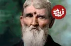 عکس| 46 سال زندگی با جای گلوله در سر 