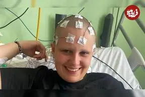 «چت‌جی‌پی‌تی» بیماری نادر یک زن را تشخیص داد