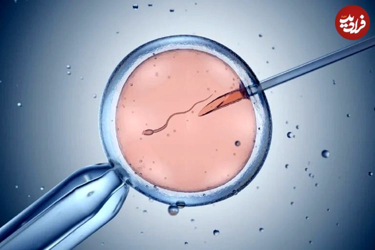 تصاویر؛ آیا در لقاح مصنوعی احتمال تولد نوزاد پسر و دختر برابر است؟