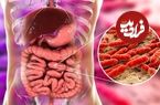 علائم یک سرطان خطرناک را بشناسیم