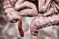 نقش پنهان آپاندیس؛ عضو ظاهراً بی‌فایده ما دست‌کم ۳۲ بار در تاریخ تکامل یافته است