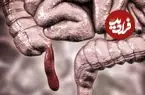 نقش پنهان آپاندیس؛ عضو ظاهراً بی‌فایده ما دست‌کم ۳۲ بار در تاریخ تکامل یافته است