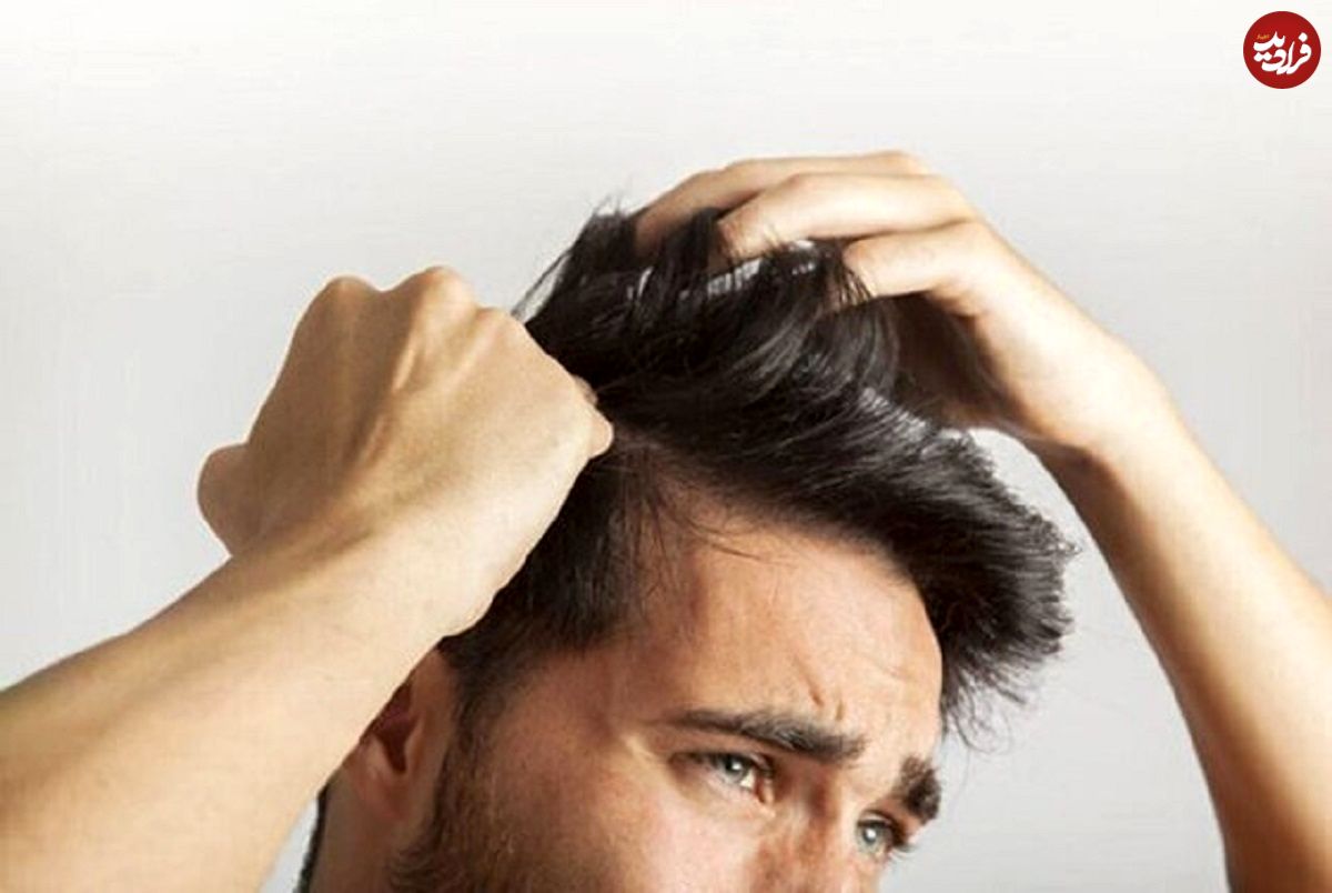 خارش سر ناشی از کمبود چه ویتامینی است؟