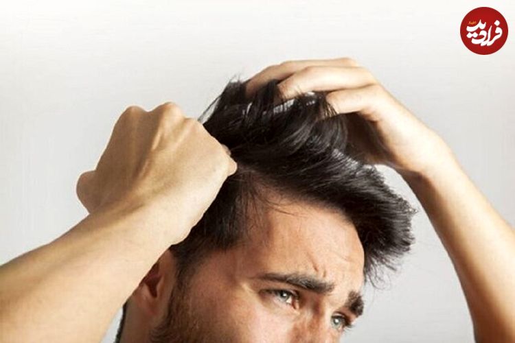 خارش سر ناشی از کمبود چه ویتامینی است؟