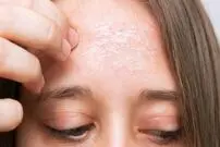 (ویدئو) راهکاری ساده برای درمان خشکی پوست 