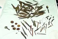 ماجرای شگفت انگیز زن قزوینی که عادت به خوردن فلز داشت
