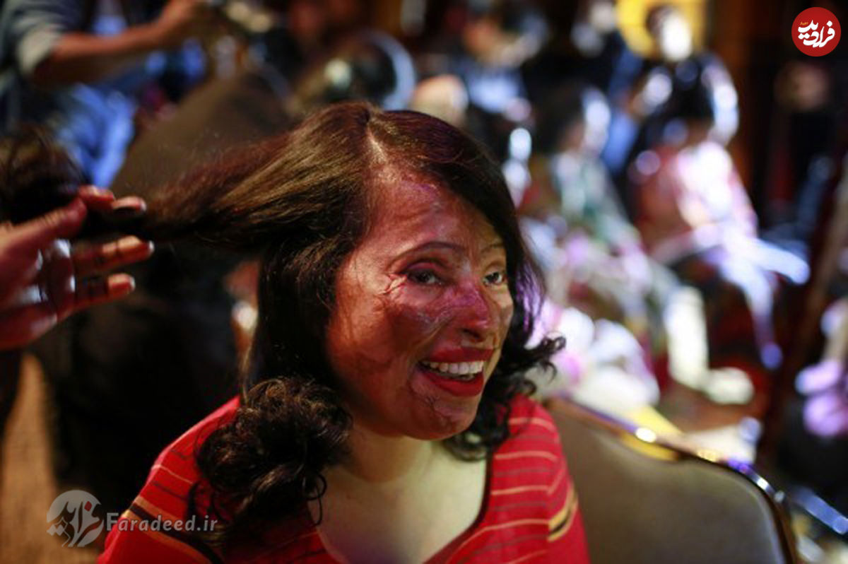 تصاویر/ زنان قربانی اسیدپاشی مدل شدند