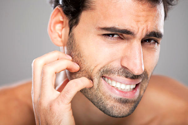 مشکلات رایج پوستی در مردان و درمان آنها