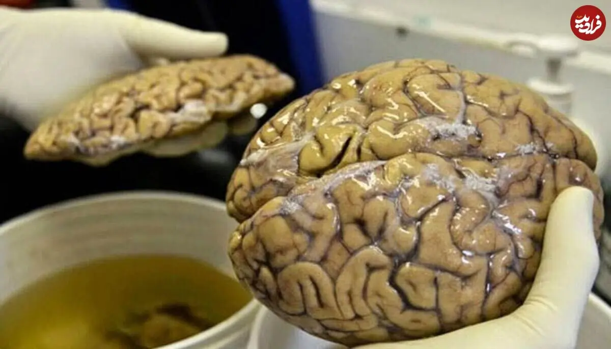 (ویدئو) نگهداری از مغز ۱۰ هزار انسان در یک زیرزمین!