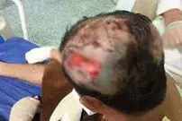 عکس/ نجات جوان قزوینی پس از حمله گله گرگ‌ها