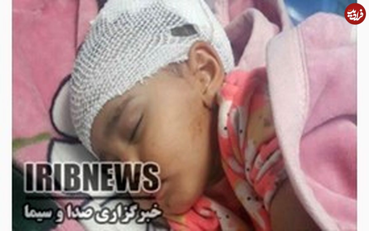 حمله خونین سگ هار به چهار نفر