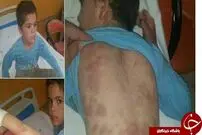 عکس/ آخرین وضعیت دانش‌آموز تنبیه شده لرستانی