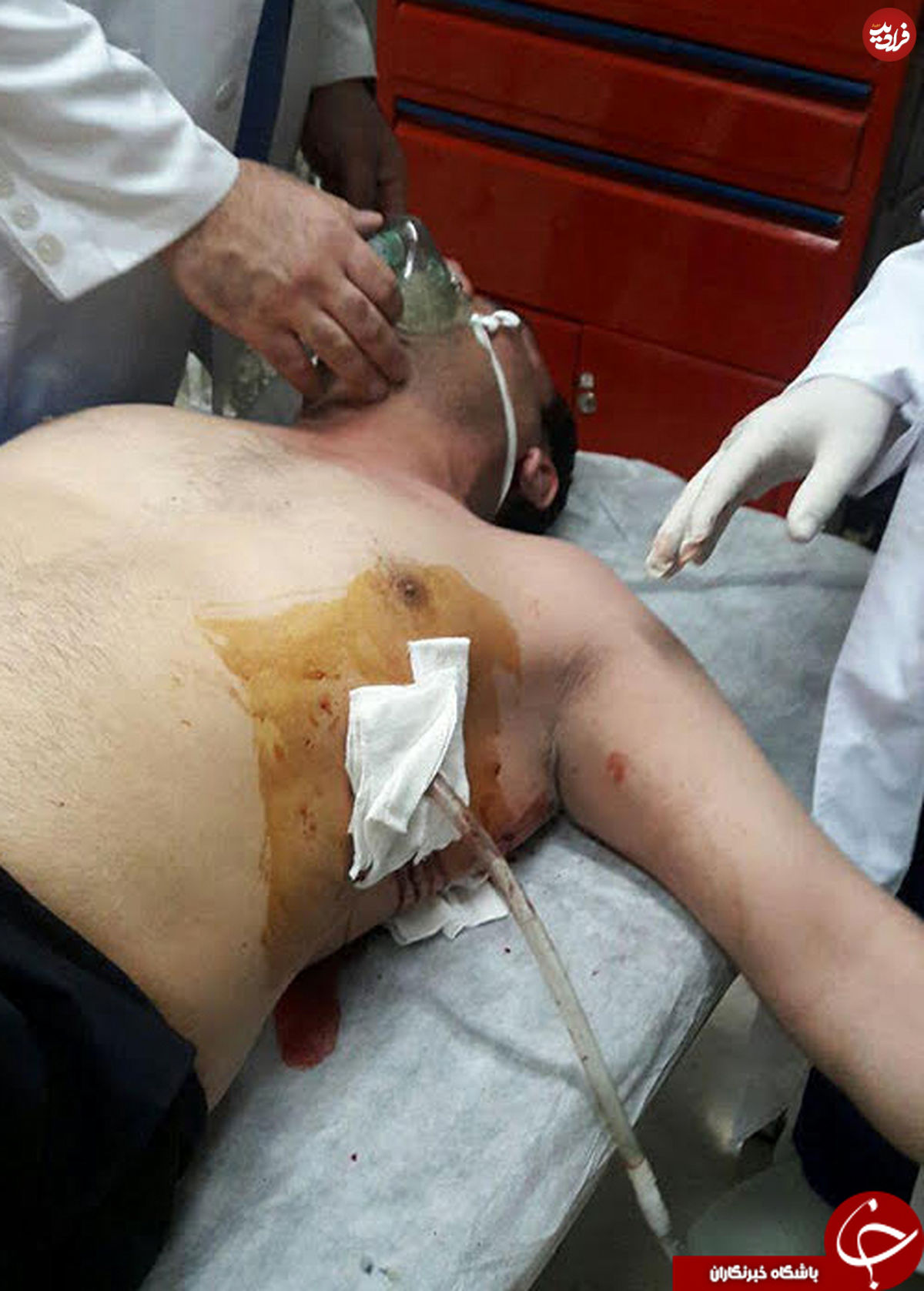 تصاویر/ حمله به دو مامور شهرداری با چاقو