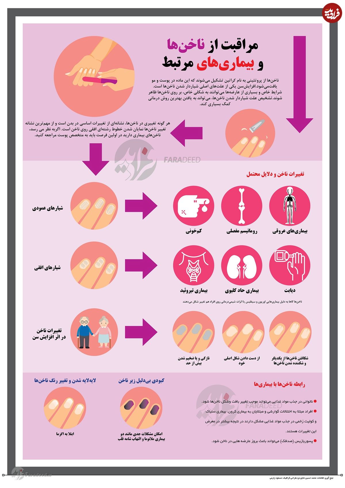 اینفوگرافی/ تشخیص بیماری از روی ناخن