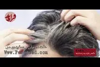 بشنوید/ علت و درمان سفیدی مو