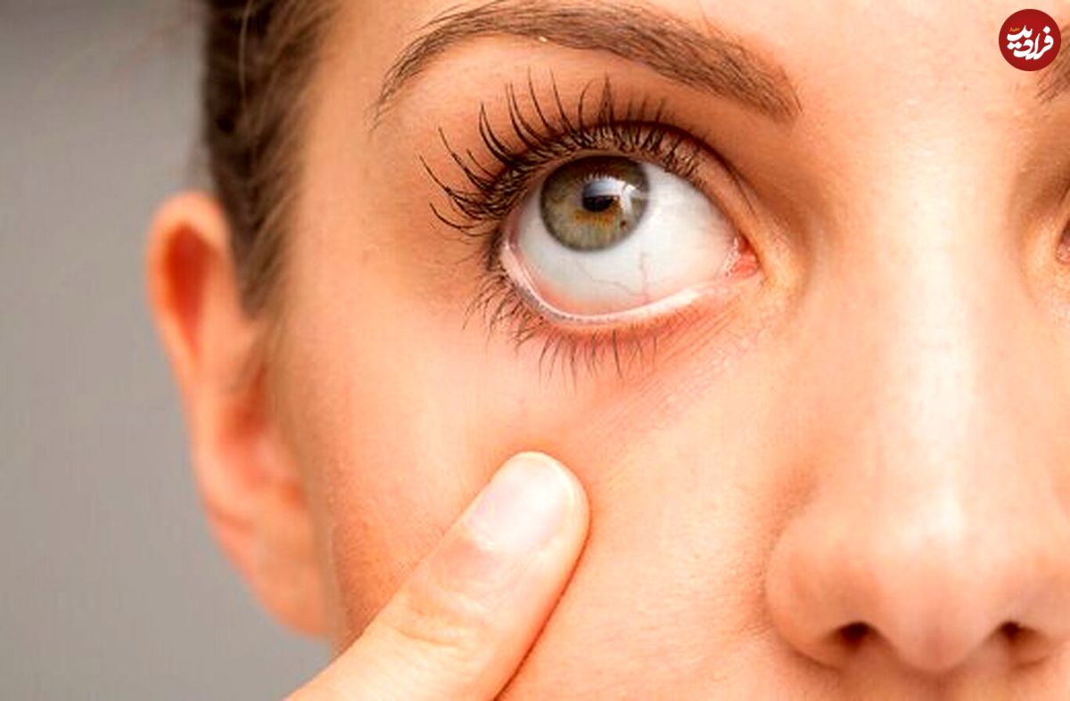 چند ویتامین مهم برای کمک به حفظ سلامت چشم