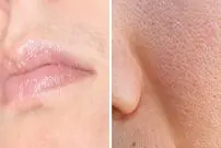 ۶ ترفند کاربردی برای حل مشکلات زیبایی، ساده اما ناخوشایند!