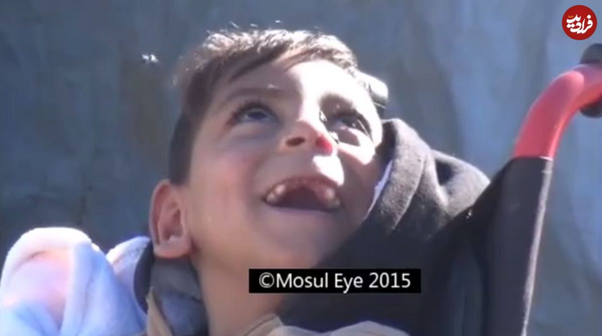 فتوای عجیب داعش درمورد کودکان مبتلا به سندروم داون