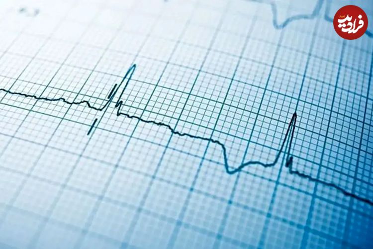 طول عمر ایرانیان افزایش یافت: میانگین سنی فوت‌شدگان به ۶۷.۷ سال رسید