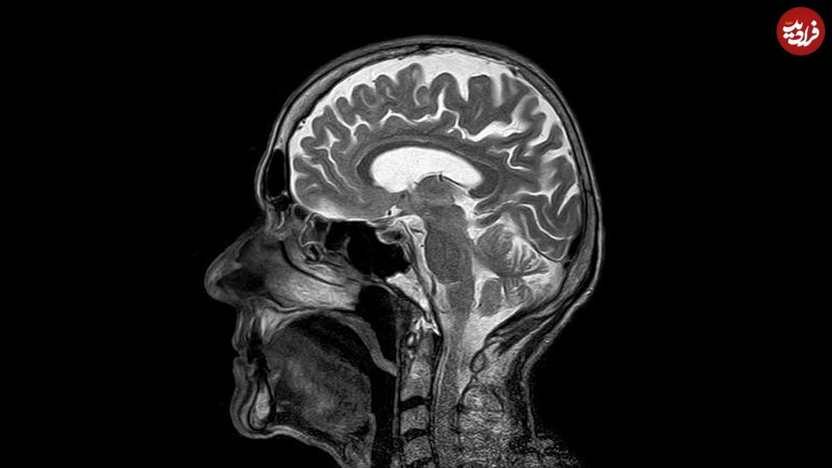 تشخیص "گفتار" از "سر و صدا" در مغز