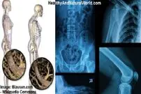 نوشابه چطور بدنتان را تخریب می‌کند؟