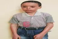 دردی که تا استخوان امیرمحمد را می‌سوزاند