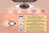 اینفوگرافی / توصیه‌هایی برای درمان تاریِ دید