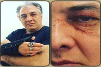 (تصویر) ایرج نوذری دچار سانحه شد