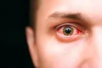 از ۴۰ سالگی به بعد بیشتر مراقب چشم‌هایتان باشید!