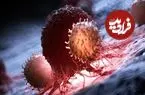 کشف پروتئینی که رشد سرطان را کُند می‌کند